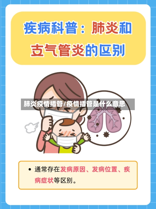 肺炎疫情插管/疫情插管是什么意思-第3张图片